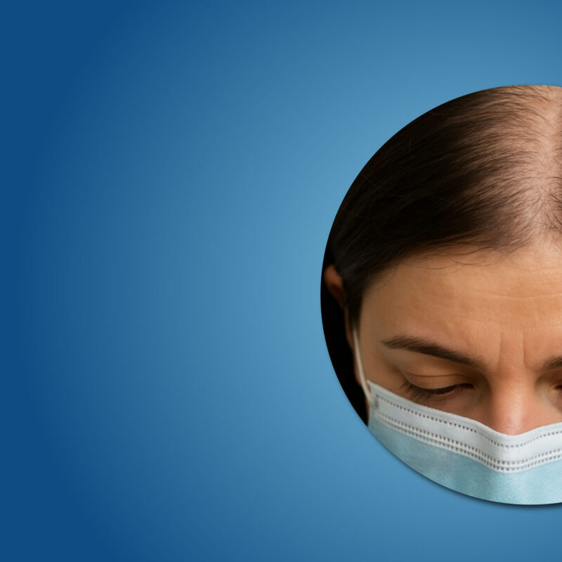 COVID-19 and Hair Loss: Causes, Recovery, and Solutions