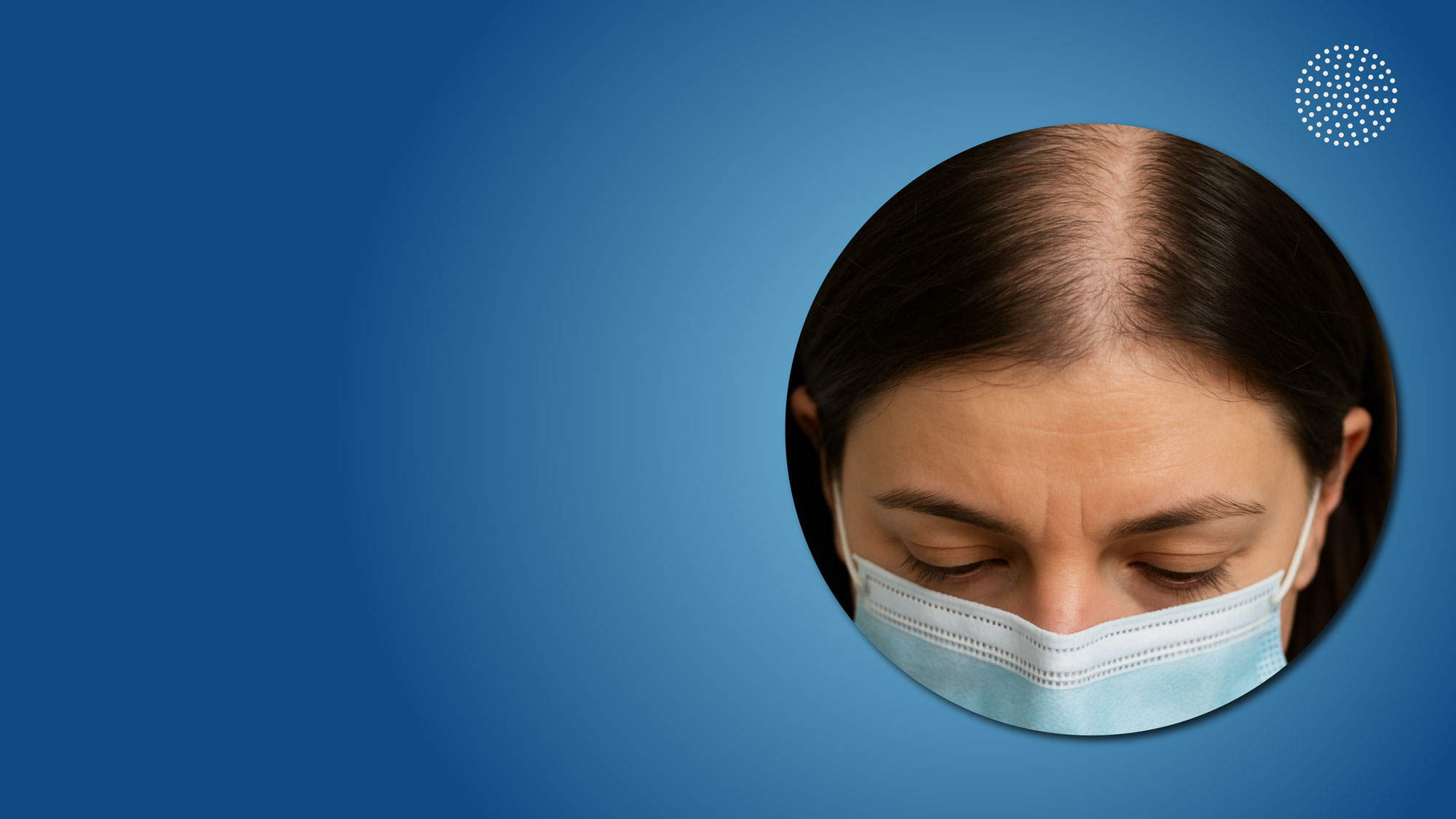 COVID-19 and Hair Loss: Causes, Recovery, and Solutions